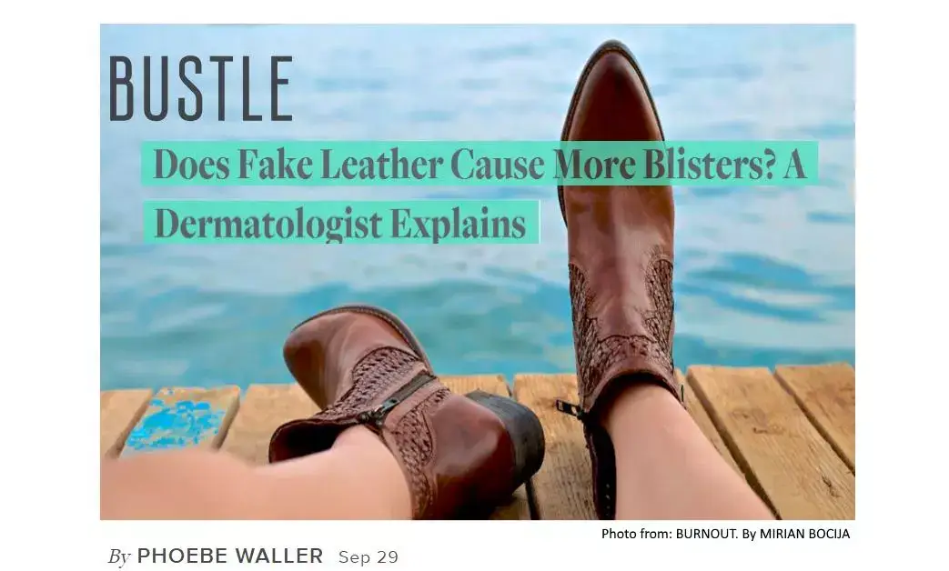 Dr. Hadley King in Bustle: Does Fake Leather Cause More Blisters?